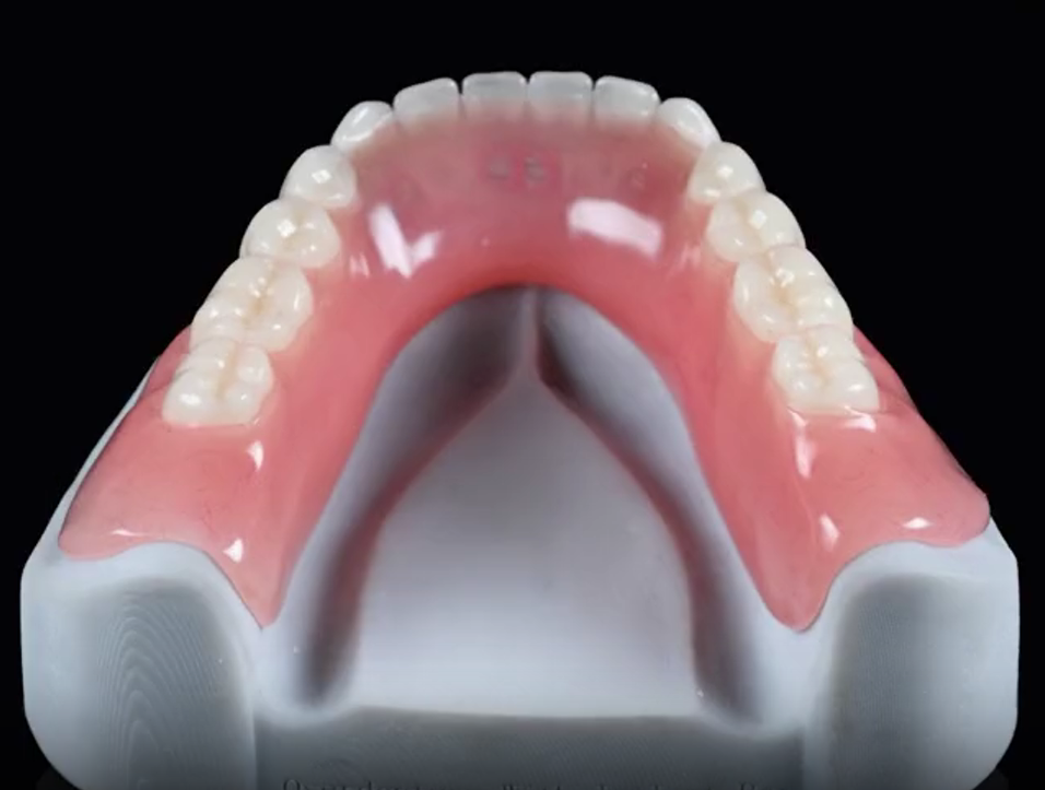 Appareil complet résine 2