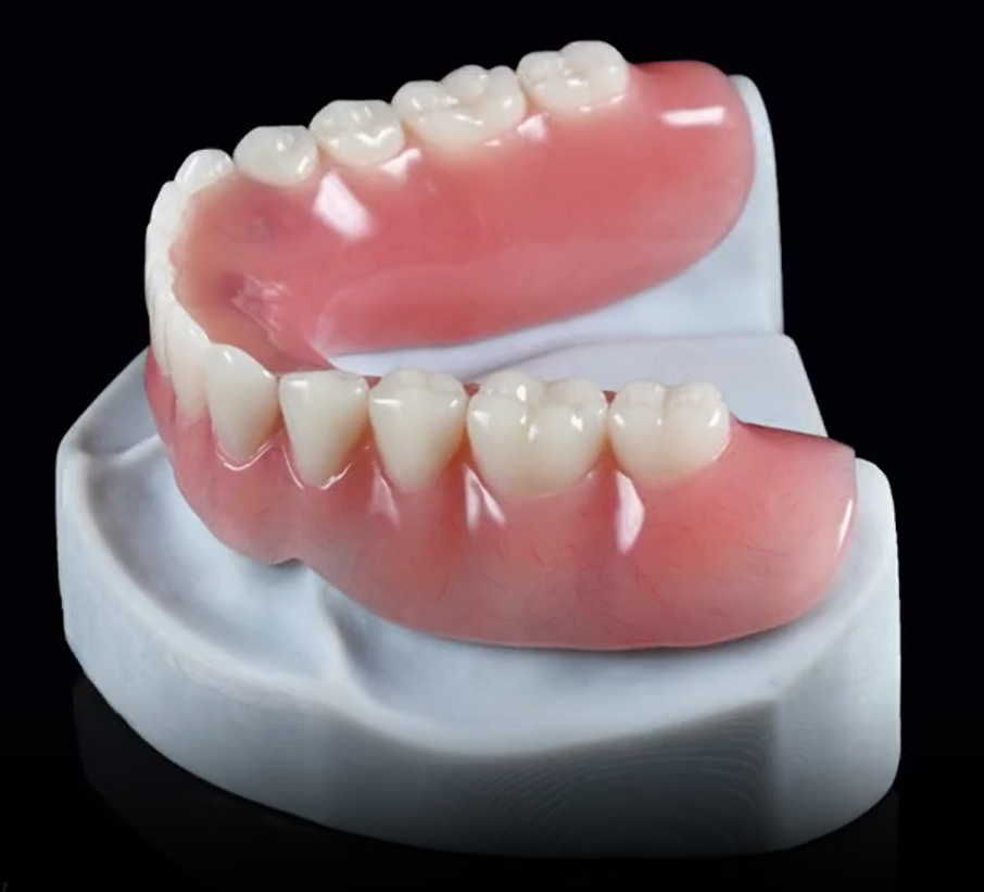 Appareil complet résine 3