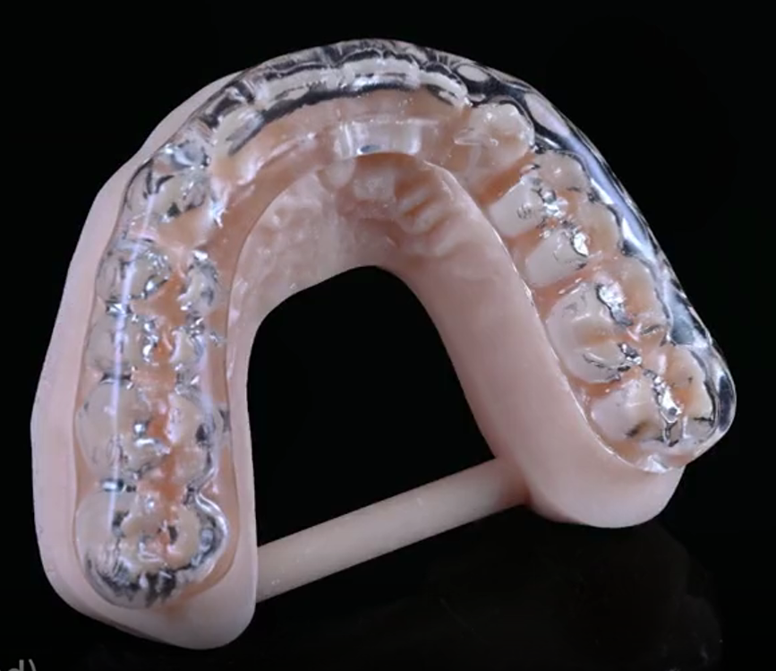 Gouttière occlusale résine dure 2