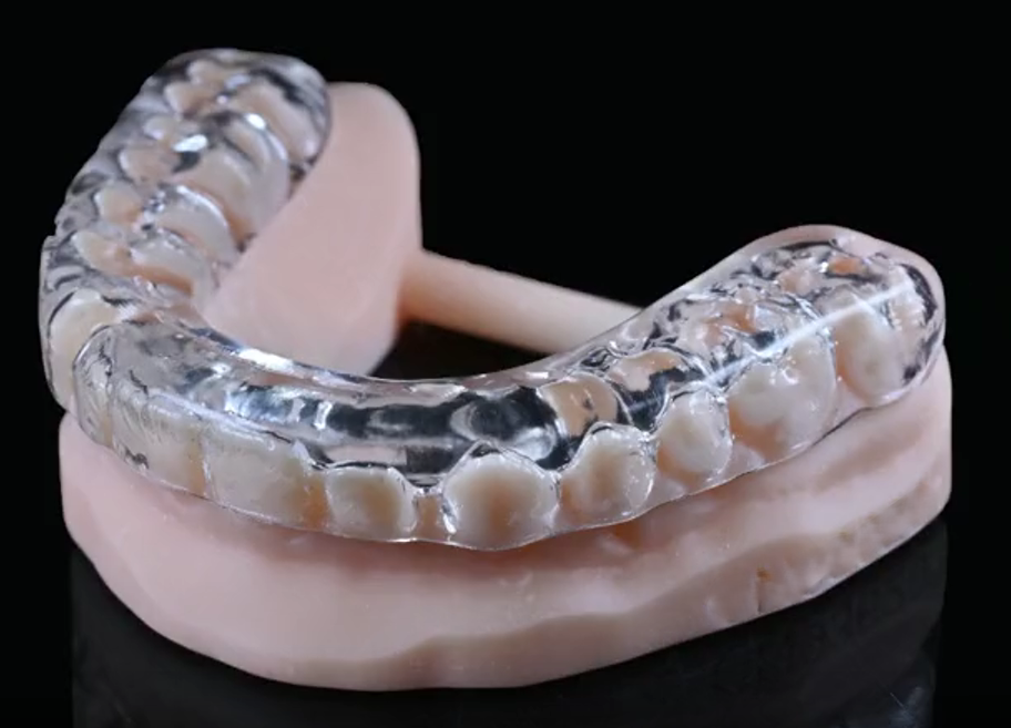 Gouttière occlusale résine dure 1