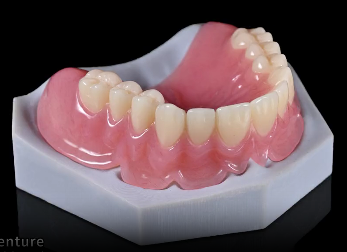 Appareil résine CFAO 4