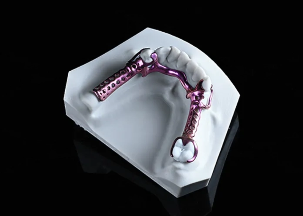 Armature titane 3D anodisé 2