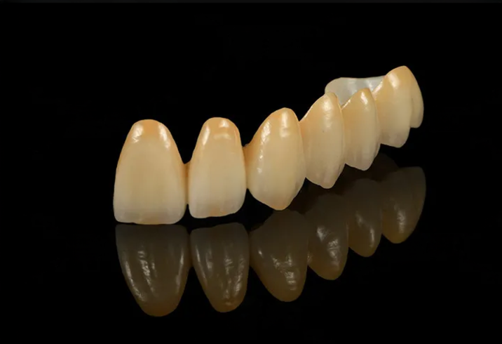 Zirconium Stratifiée 3