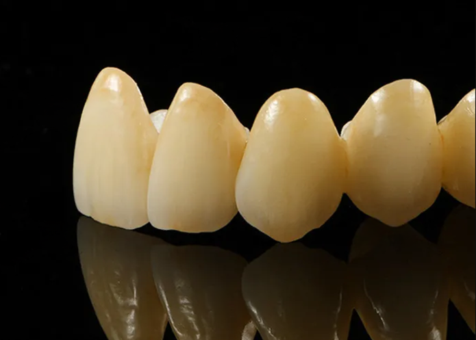 Zirconium Stratifiée 2