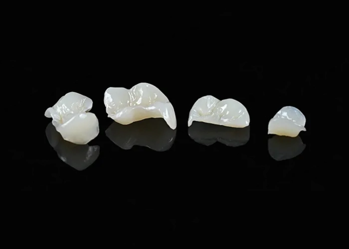 Inlay/Onlay Adoro Composite 3