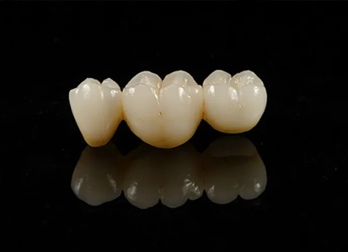 Pilier titane transvissé 4