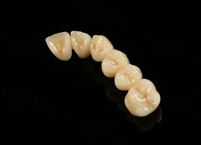 Zirconium Stratifiée 4